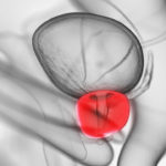 Anatomische 3D Darstellung einer Prostata mit Umgebung